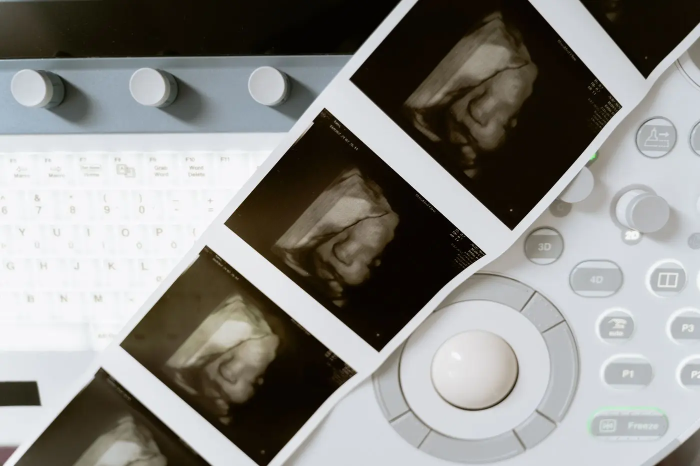 Ultrasound printouts on a clinic desk
