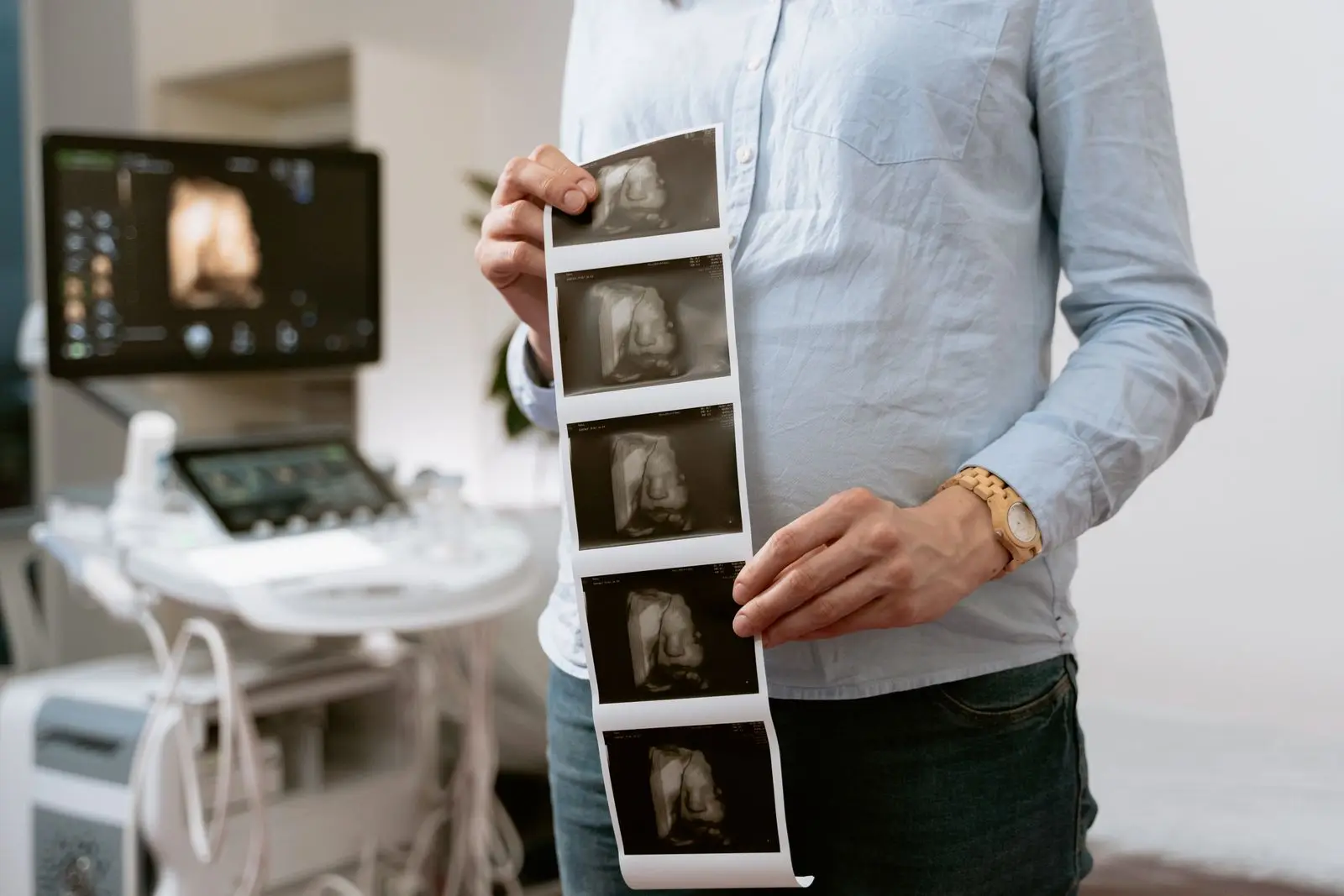 Person holding a strip of printed ultrasound images in front of an ultrasound machine in a clinic