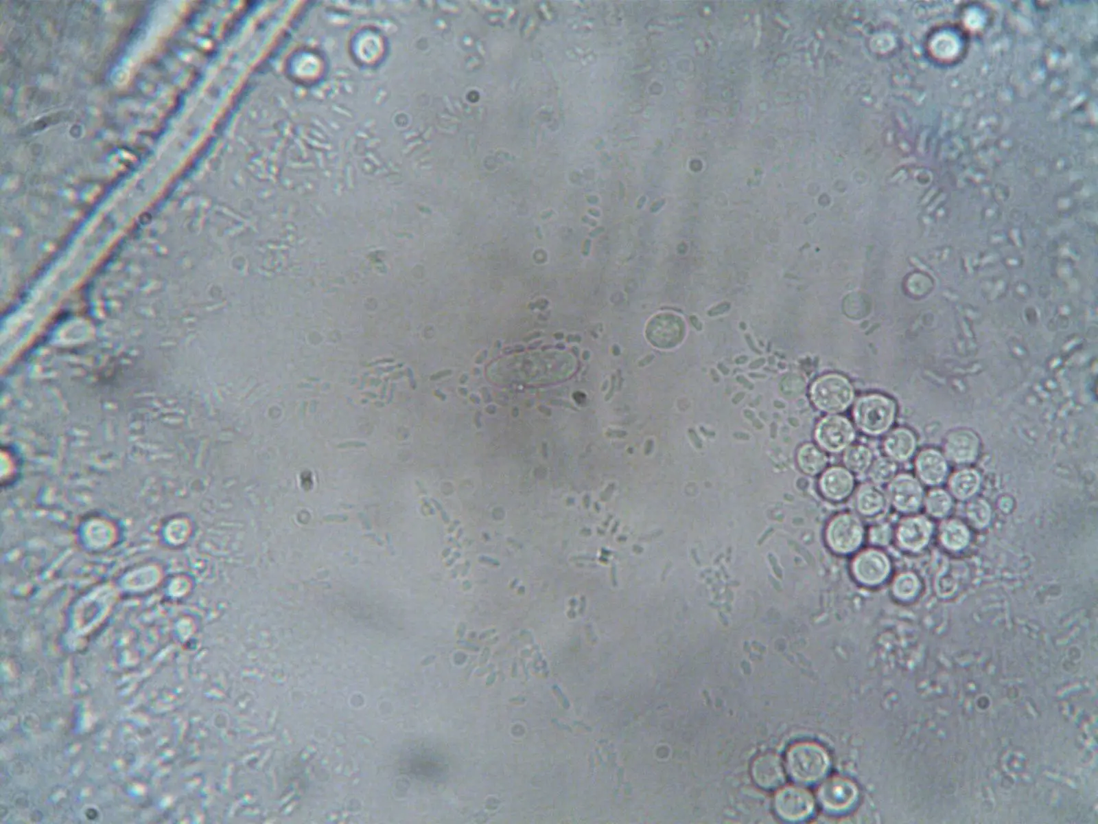 Cells seen under a microscope, representing fertilization and early cell division