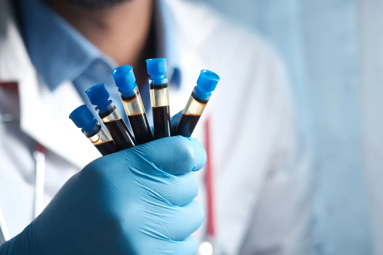 Medical technician holding blood test samples for prenatal screening